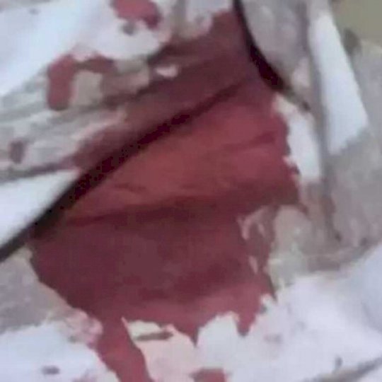 Criança vê mãe ensanguentada após agressão e pede socorro a vizinhos em Dourados