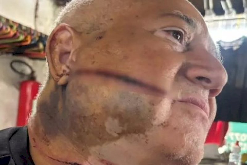 &ldquo;Me livrei da morte 2 vezes&rdquo;, diz comerciante ferido em tentativa de roubo