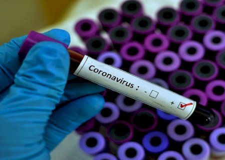 Frigorífico fará testagem de Covid-19 em funcionários no MS
