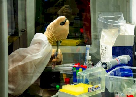 Fiocruz inicia estudo da progressão da covid-19 em seres humanos