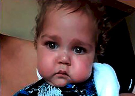 Família busca arrecadar R$ 200 mil para cirurgia de reconstrução do esôfago de criança