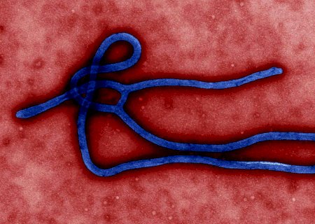 Guiné declara novo surto de ebola