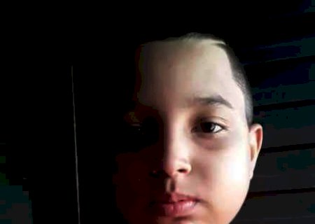 M&atilde;e faz vaquinha para cirurgia de menino de 9 anos com doen&ccedil;a rara