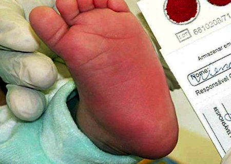 Campanha vai divulgar informação segura sobre as doenças raras