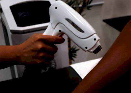 Pele negra não pode fazer depilação a laser? Descubra mitos e verdades sobre esse procedimento