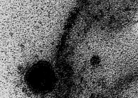 Novo coronavírus infecta e se replica em glândulas salivares