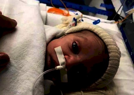 Ap&oacute;s terceira cirurgia no cora&ccedil;&atilde;o, beb&ecirc; precisa de doa&ccedil;&otilde;es de sangue
