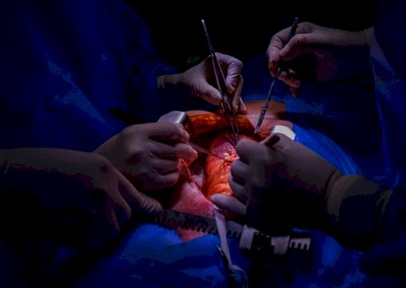 Fila do transplante de órgãos tem 428 pessoas em MS