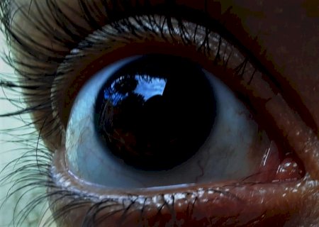 Retinopatia: sintomas da doença silenciosa nos olhos que acomete diabéticos