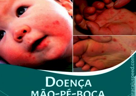 Secretaria Municipal de Saúde de Maracaju  emite alerta quanto a doença “mão-pé-boca'