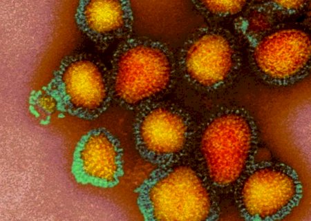 Jovem de 21 anos é 1º óbito por gripe A H3N2 em MS