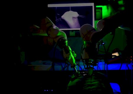Robô de universidade dos EUA realiza cirurgia Laparoscópica sem ajuda humana