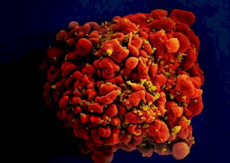 Estudo identifica variante mais virulenta do HIV desconhecida por d&eacute;cadas&nbsp; - Sa&uacute;de - Estad&atilde;o