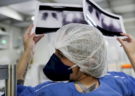 Médico alerta para riscos da tuberculose pulmonar não tratada