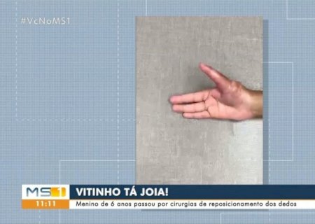 Garoto de 6 anos volta a desenhar após cirurgia e 'ganhar' polegares: 'era difícil, agora ficou mais fácil'