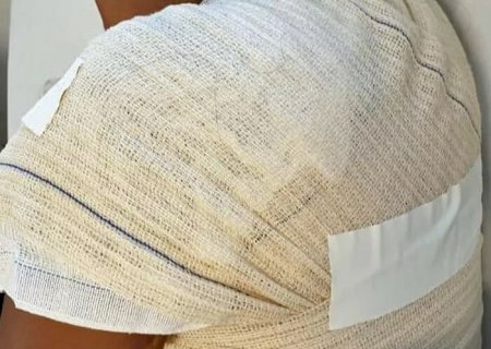 Marido surta e joga água quente na esposa em Dourados