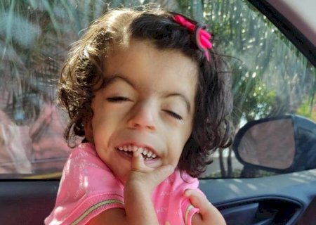 Maria Valentina tem uma síndrome rara e pede ajuda pela plataforma Donativa