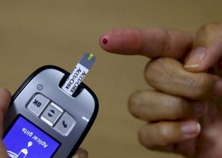 Comissões discutem adoção de protocolo clínico no SUS para prevenir retinopatia diabética