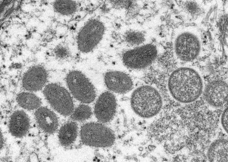MS tem 61 casos confirmados de varíola dos macacos