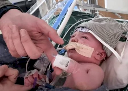 Primeiro transplante parcial de coração do mundo é realizado