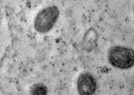 MS tem 10 pacientes com casos ativos de var&iacute;ola dos macacos
