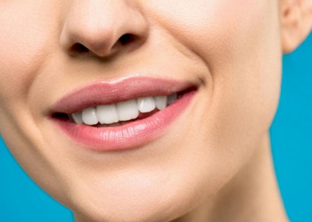 Gengivite: Como uma higiene correta pode ajudar a prevenir a doença?