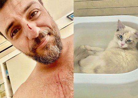 Rodrigo Lombardi adota gata, sofre arranhões e fica ensanguentado