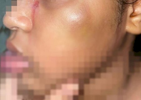 Pai tortura filha pequena com faca quente e pimenta no ouvido em Campo Grande