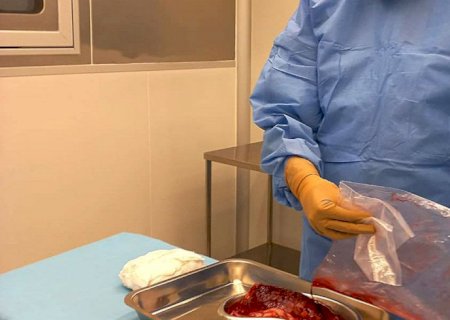 Pesquisa desenvolve curativos biológicos à base de placenta
