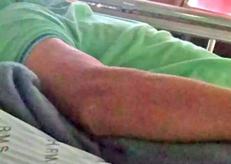 Com aparelho de R$ 2,8 milh&otilde;es inoperante, paciente fica sem exame