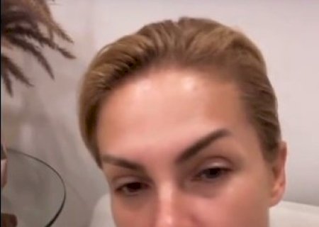 Ana Hickmann se defende após ex-marido dizer que ela é alcoólatra