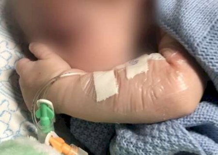 Regional pede ajuda a outros hospitais para implante de cateter em beb&ecirc;