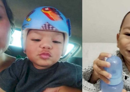 Bebê precisa de R$ 10 mil para tratar plagiocefalia em Três Lagoas; SUS não cobre