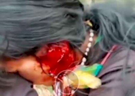 Duas indígenas são internadas com f3rimentos após confront0 com Choqu3