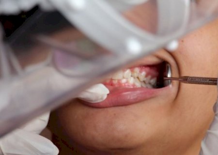 Criação da Rede de Atenção à Saúde Bucal amplia assistência e garante acesso integral