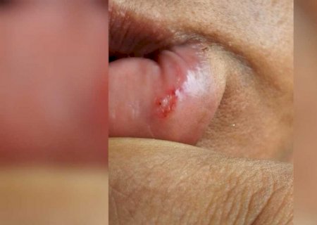 Mulher é agredida pelo marido após recusar relação sexual em Dourados