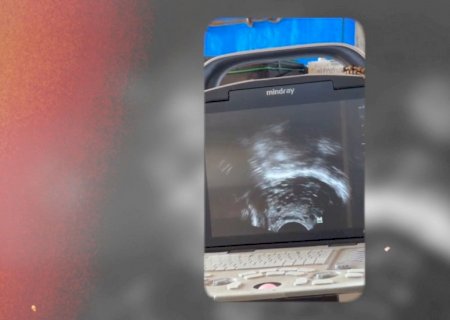 Estudo da Embrapa aponta antecipação de puberdade sexual em novilhas com ajuste energético