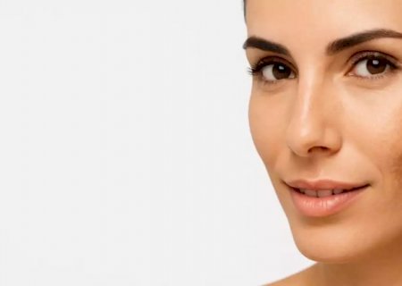 Como tratar manchas e melasma com segurança e eficácia. Confira!