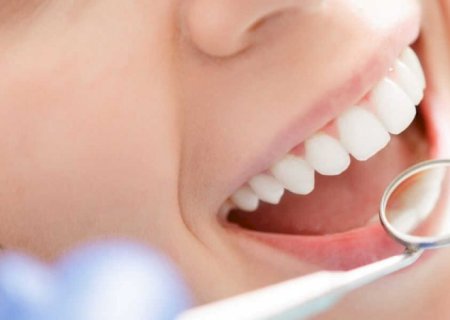 Periodontite: doença bucal que afeta milhões de brasileiros e quase ninguém percebe