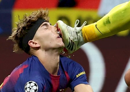 Jogador do Barcelona tem forte sangramento após choque com goleiro do Atlético na Champions
