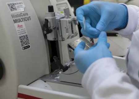 SUS inclui nova terapia para pacientes adultos com leucemia mieloide