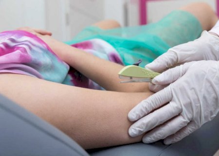 Você já ouviu falar do 'Chip da Beleza'? Entenda os perigos desse nome para o tratamento