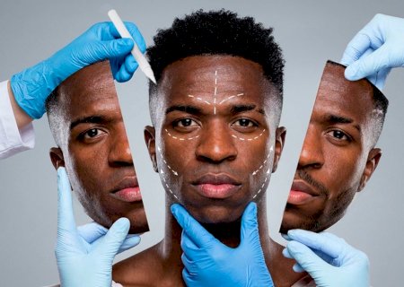 "Eles vêm escondidos": por que harmonização facial virou moda entre jogadores de futebol