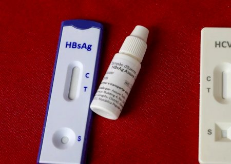 Dia Mundial de Luta contra as Hepatites Virais alerta para prevenção