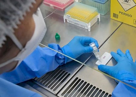 Anvisa atualiza regras sobre controle de qualidade em laboratórios