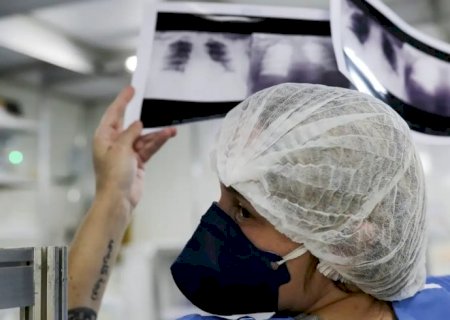 Diagnóstico tardio dá poucas chances de cura para o câncer de pulmão