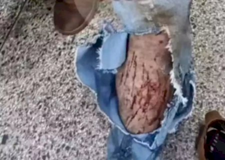 Nova Itamarati - Trabalhador rural relata ter sido atacado por onça durante colheita